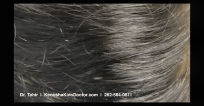 A Close Up Of A Person 'S Hair With Dr. Tahir I Kenoshakidsdoctor.com Written On The Bottom GIF