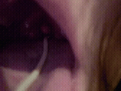 A Close Up Of A Person 'S Mouth With A Toothbrush In It . GIF
