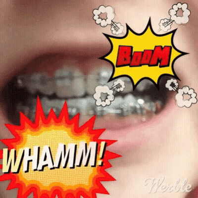 A Close Up Of A Person 'S Mouth With Braces And A Boom Sign GIF