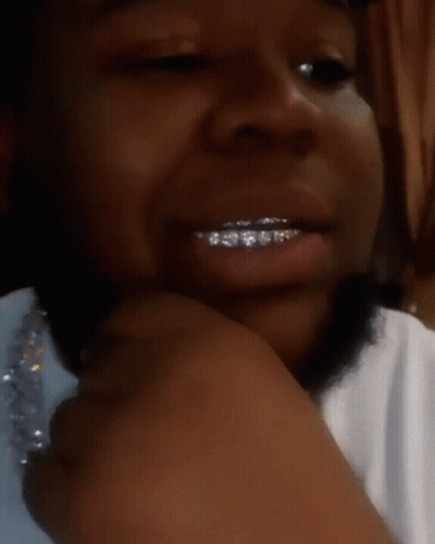 A Close Up Of A Person 'S Mouth With Braces On Their Teeth GIF