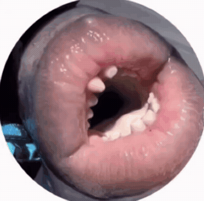 A Close Up Of A Person 'S Mouth With Their Teeth Visible GIF