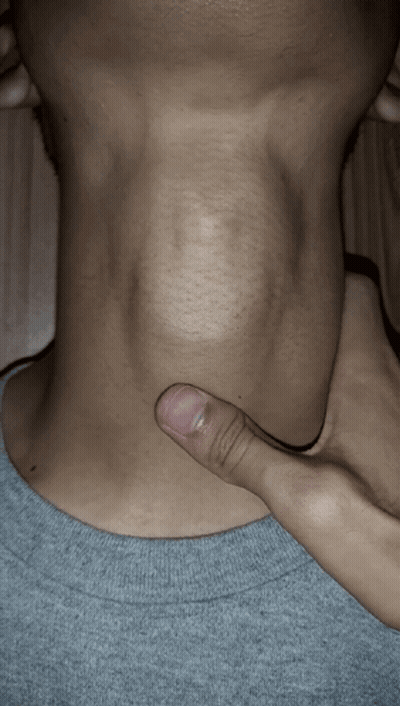 A Close Up Of A Person 'S Neck With Their Thumb On It GIF