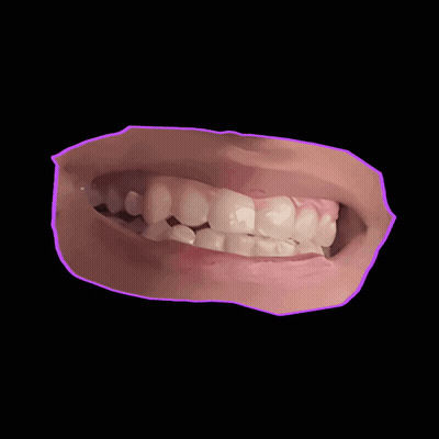 A Close Up Of A Person 'S Teeth With A Purple Outline Around It GIF