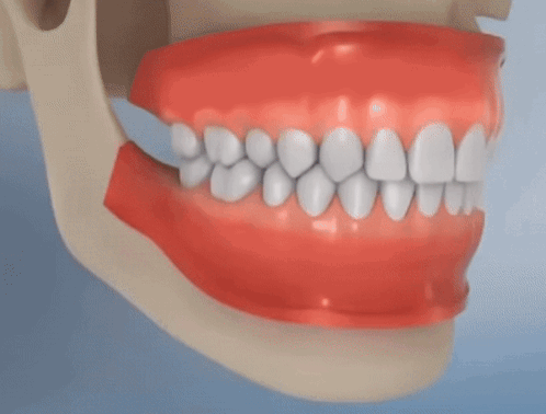 A Close Up Of A Tooth With A Hole In It Being Pulled Out GIF