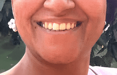 A Close Up Of A Woman 'S Face With A Smile And Earrings GIF
