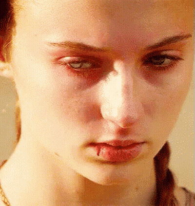 A Close Up Of A Woman 'S Face With Blood Coming Out Of Her Mouth . GIF