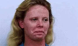 A Close Up Of A Woman 'S Face With Red Freckles . GIF