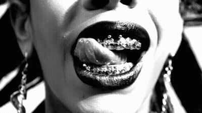 A Close Up Of A Woman 'S Mouth With Braces On Her Teeth GIF