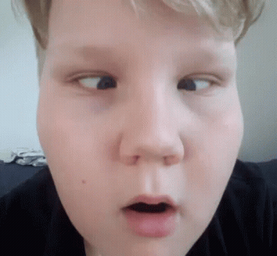 A Close Up Of A Young Boy 'S Face With His Mouth Open Making A Funny Face . GIF