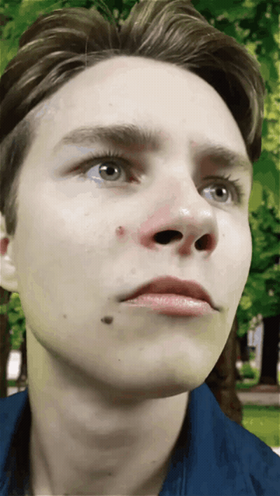 A Close Up Of A Young Man 'S Face With A Red Spot On His Nose GIF