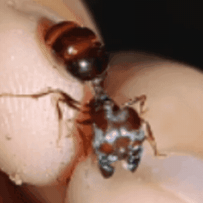 A Close Up Of An Ant On A Person 'S Hand GIF