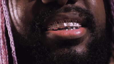 A Closeup Of A Man 'S Mouth With Braces On His Teeth GIF