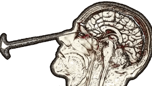 A Drawing Of A Man 'S Head With A Needle Sticking Out Of It Sticker