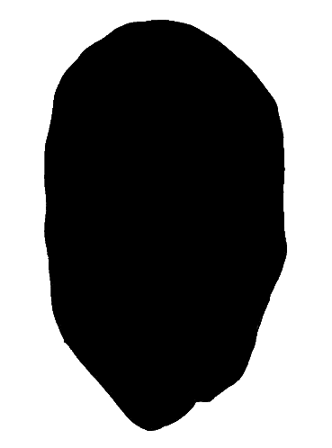 A Drawing Of A Skull With Black Eyes And Stitches On It Sticker
