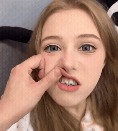 A Girl With Braces On Her Teeth Is Being Touched By A Person GIF