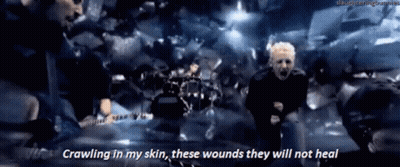 A Man Is Crawling In His Skin While Playing A Guitar And Singing . GIF