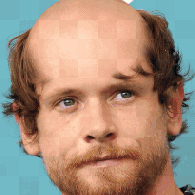 A Man With A Bald Head And A Beard Looks At The Camera GIF