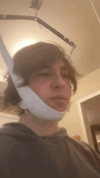 A Man With A Bandage On His Face Is Standing In A Room GIF