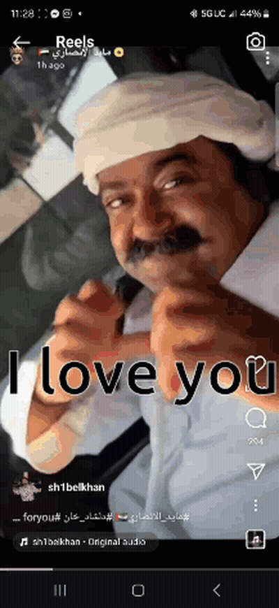 A Man With A Bandage On His Head Is Giving The Thumbs Up Sign With The Words I Love You Below Him GIF