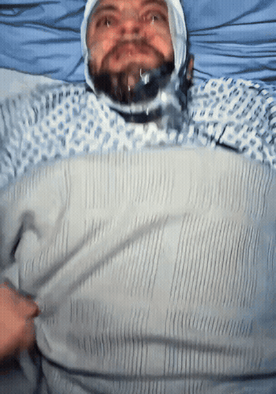 A Man With A Bandage On His Head Is Laying In Bed GIF