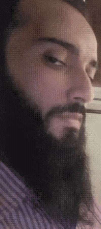 A Man With A Beard And Mustache Is Wearing A Striped Shirt And Looking At The Camera . GIF