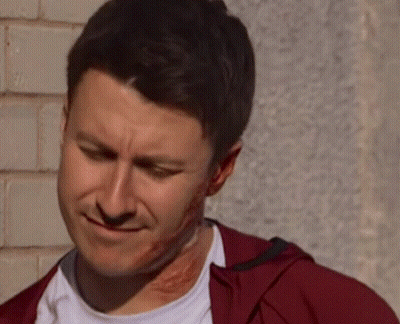 A Man With A Scar On His Face Is Smiling . GIF