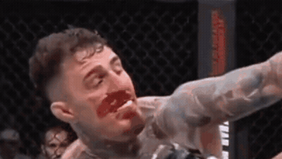 A Man With Blood On His Face Is Laying On The Ground In A Cage . GIF
