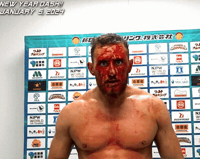 a man with blood on his face is standing in front of a sign that says new year dash january 5th 2024