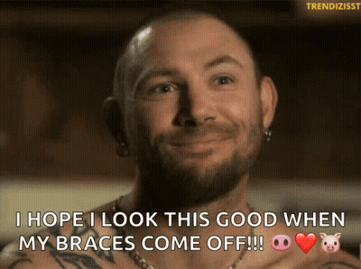 A Man With Braces On His Teeth Is Smiling And Saying I Hope I Look This Good When My Braces Come Off GIF