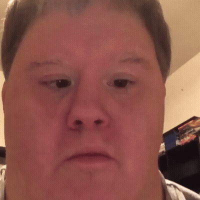 A Man With Down Syndrome Is Making A Funny Face With His Eyes Closed And His Mouth Open . GIF