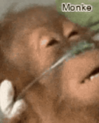 A Monkey With An Oxygen Mask On Its Face Is Laying Down . GIF