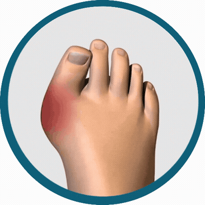 A Person 'S Foot With A Red Spot On The Toe GIF