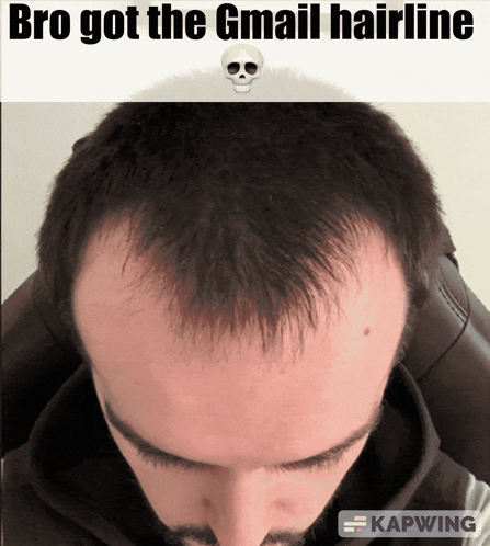 A Picture Of A Man 'S Head With The Caption " Bro Got The Gmail Hairline " GIF
