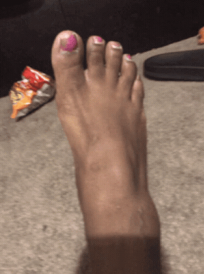 A Woman 'S Foot With Pink Nail Polish On The Toe GIF