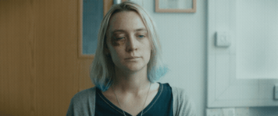 A Woman With A Black Eye And A Necklace On Her Neck GIF