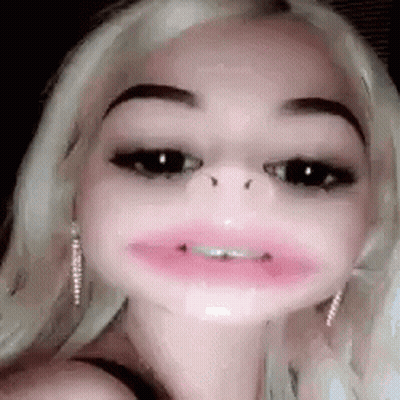 Braces GIFs