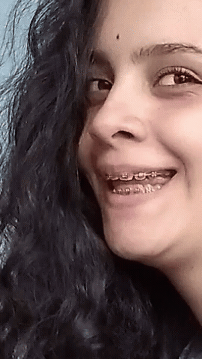 A Woman With Braces On Her Teeth Is Smiling For The Camera GIF