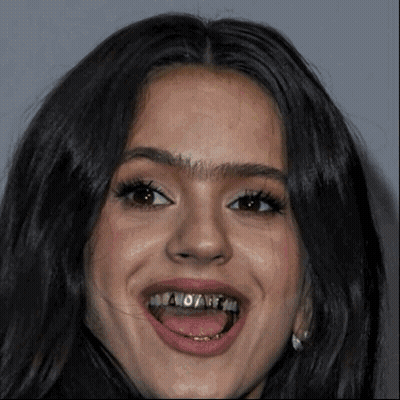 A Woman With Braces On Her Teeth Is Smiling With Her Mouth Open GIF