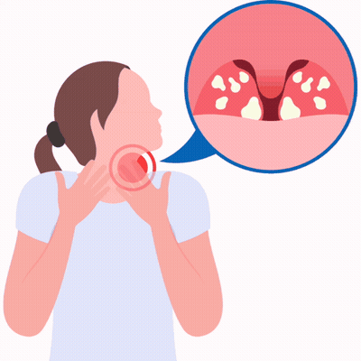 An Illustration Of A Girl With A Sore Throat And The Word War Behind Her GIF