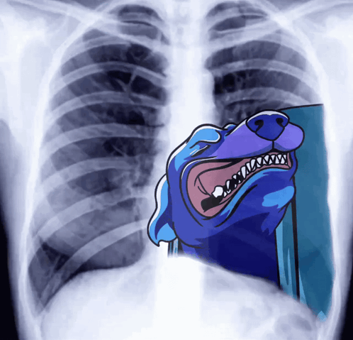 An X-Ray Of A Person 'S Chest With A Cartoon Of A Dog On It GIF