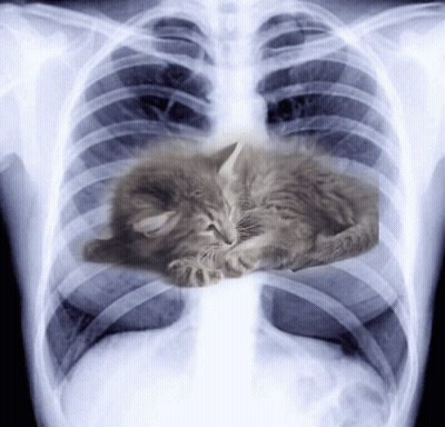 An X-Ray Of A Person 'S Chest With A Kitten Sleeping In It GIF