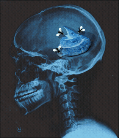 An X-Ray Of A Person 'S Head With The Letter R On The Bottom GIF