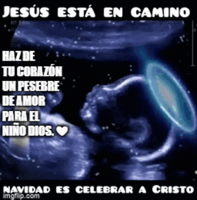 Baby Ultrasound Jesus Esta En Camino GIF