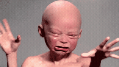 Bald Baby Crying With Funny Face GIF