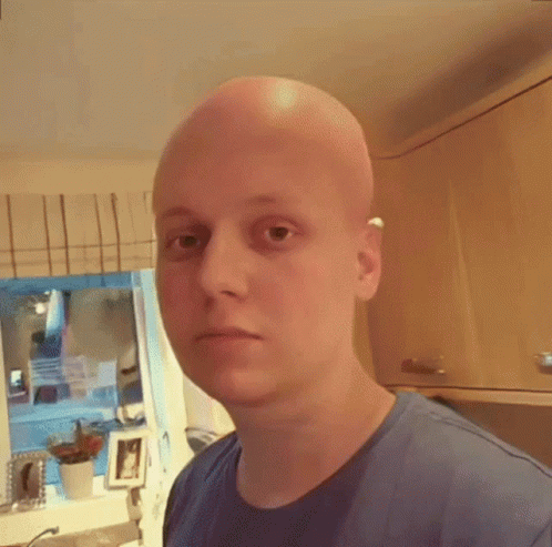 Bald Man In Blue Shirt Looking At Camera GIF