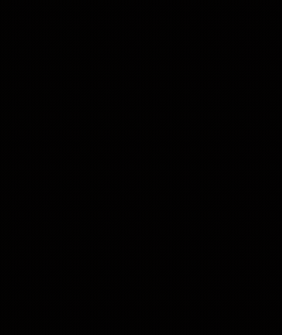 Bald Man In Glasses And Black Shirt Looking At Camera GIF