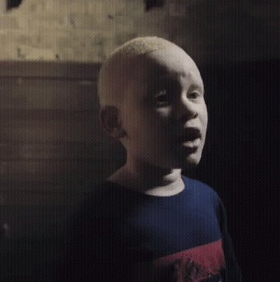 Bald Young Boy Making Funny Face GIF
