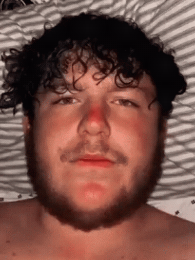 Bearded Curly-Haired Man Laying In Bed With Red Nose GIF
