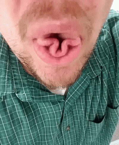 Bearded Man In Green Plaid Shirt Open Mouth GIF