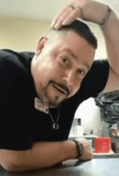 Bearded Man Sitting With Hand On Head Making Funny Face GIF